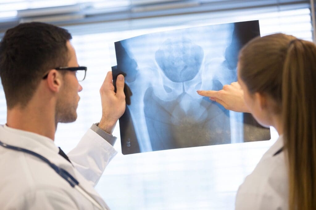 Medical professionals evaluating a hip X-ray for a potential Synovo implant lawsuit case.
