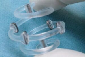 Biozorb Marker Lawsuit