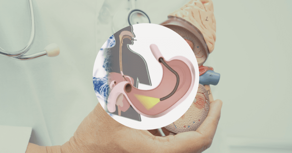 Close-up of an Olympus TJF-Q190V duodenoscope elevator mechanism and a medical illustration of CRE "superbug" bacteria.