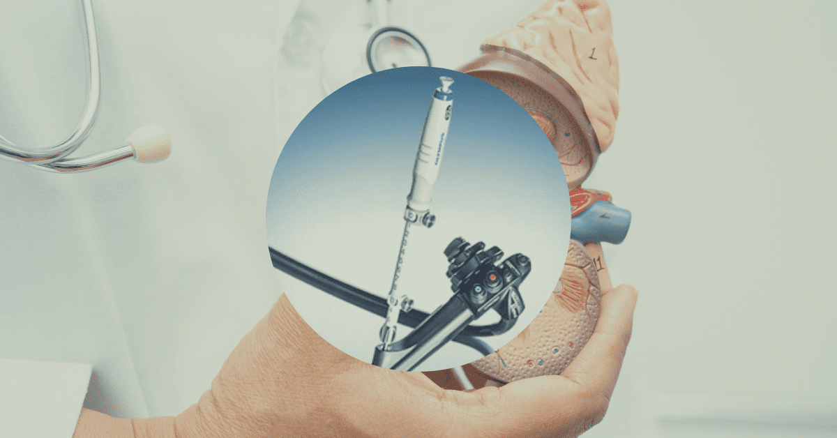 Microscopic view of an Olympus duodenoscope tip under 10X magnification showing contamination and design defects linked to 2025-2026 recalls.