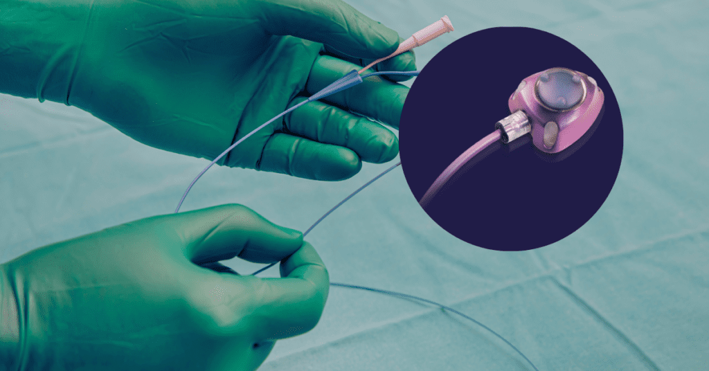 Close-up of a Bard PowerPort device showing the catheter tubing and reservoir used for chemotherapy.